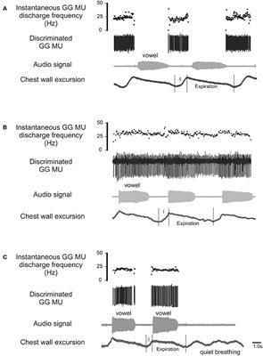 Association between Laryngeal Airway Aperture and the Discharge Rates of Genioglossus Motor Units